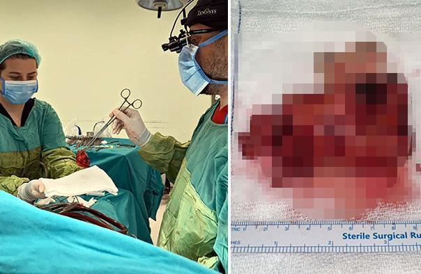 Kalbinden çıkan doktorları bile şaşırttı: Mucizevi bir olay
